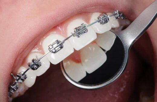Dentistas cerca de mi 8 Dentistas cerca de mi