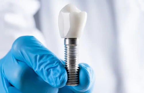 Dentistas cerca de mi 9 Dentistas cerca de mi