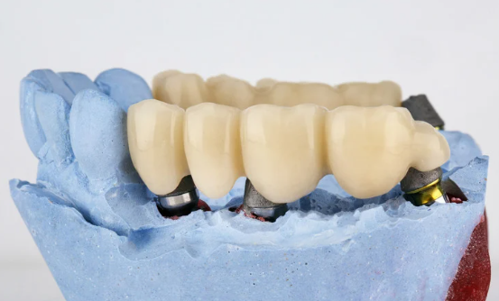 Dentistas cerca de mi 11 Dentistas cerca de mi