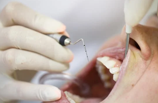 Dentistas cerca de mi 12 Dentistas cerca de mi